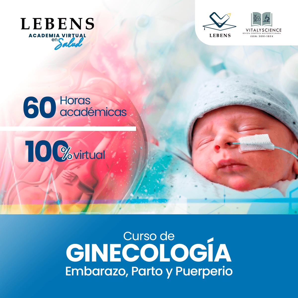 Evento 9